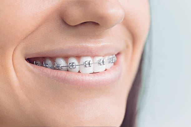 Best Dentures (Full and Partial)  in Broussard, LA